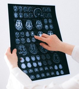 Traumatic Brain Injury Cases